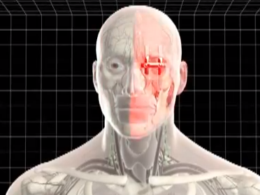 3D plastische chirurgie