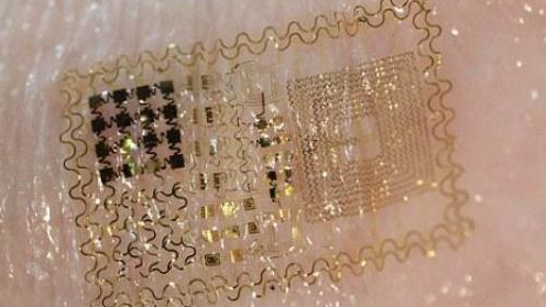 Elektronische huid, de sensor voor zorg van de toekomst