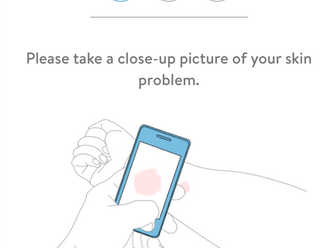 Klara app: online hulp bij huidproblemen