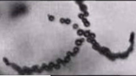 Energie voor nanorobots via ons maagzuur
