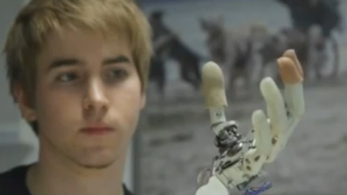 Liever een bionische hand dan de natuurlijke versie