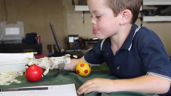 3D geprinte handprothese