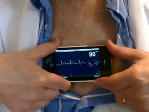 Iphone als ECG