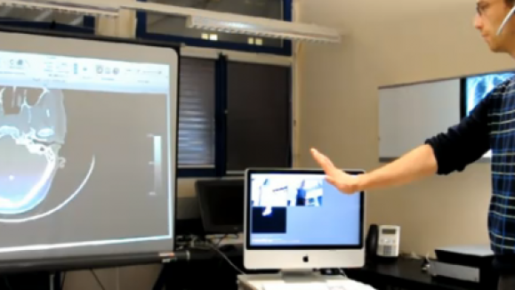 Kinect in de medische wereld